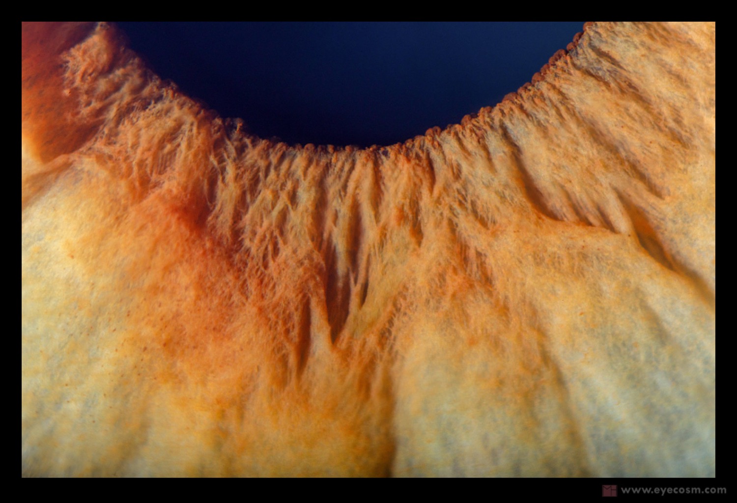 EYE MOUNTAINS
